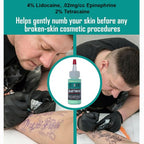 Sustaine Blue Gel - During Procedure Numbing Gel - 34ml